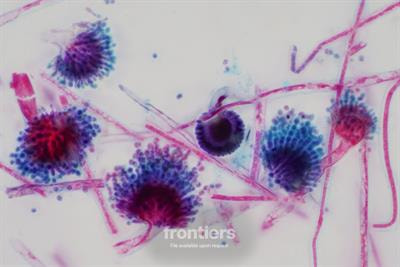 Cover image for research topic "Predicting, Managing, and Minimizing Mycotoxicosis in Farm Animals"