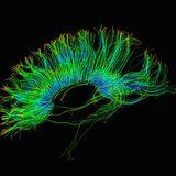 Cover image for research topic "Protecting Privacy in Neuroimaging Analysis: Balancing Data Sharing and Privacy Preservation"