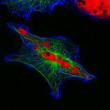 Cover image for research topic "Novel Molecular Targets and Therapies for Pediatric Extracranial Solid Tumors"