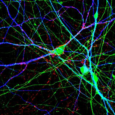 Cover image for research topic "Molecular Mechanisms Underlying Psychiatric Disorders"