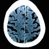Cover image for research topic "The Role of Neuroimaging and Neurostimulation in Detecting and Treating Alzheimer's Disease and Mild Cognitive Impairment"