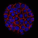 Cover image for research topic "Recent Developments in Pancreatic Cancer Radiotherapy - Vol II"