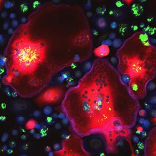 Cover image for research topic "The Mononuclear Phagocyte System in Infectious Disease"