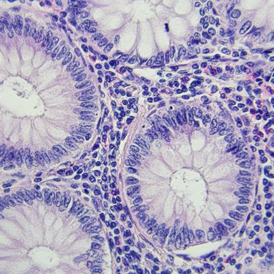 Cover image for research topic "Targeting the Tumor Microenvironment for Effective Treatment of Gastrointestinal Cancers"