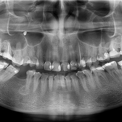 Cover image for research topic "Perivascular Niche and Stem Cell Signaling in Tooth"