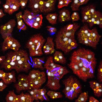 Cover image for research topic "Amoebae as Host Models to Study the Interaction with Pathogens "