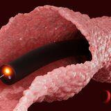 Cover image for research topic "Artificial Intelligence for Early Diagnosis of Colorectal Cancer"