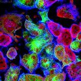 Cover image for research topic "Toll-like Receptor Expression in Transformed Cells: Role in Tumor Development and Cancer Therapies"
