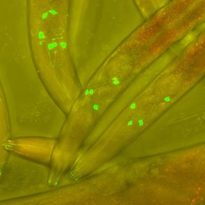 Cover image for research topic "Plant Parasitic Nematode–Host Interactions: Mechanisms and Exploitative Management Strategies"