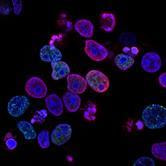 Cover image for research topic "Combinational therapy and nanotechnologies in combating pathogenic microbes and antibiotic resistance"