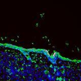 Cover image for research topic "Cancer Immunotherapy in Solid Organ Transplant Recipients"