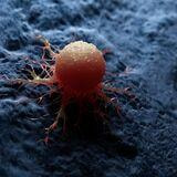 Cover image for research topic "Metals in Cancer: from Intracellular Signaling to Therapy"