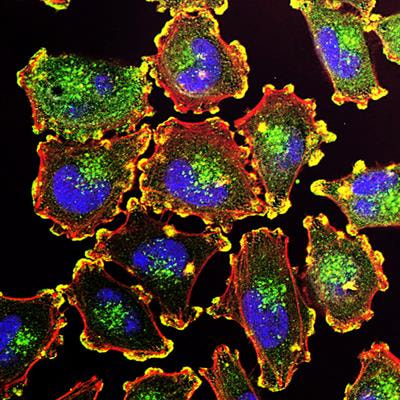 Cover image for research topic "Metabolic reprogramming in cancer"