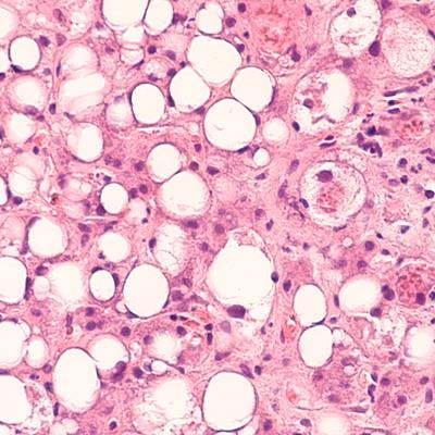 Cover image for research topic "The Gut-Liver Axis: the Main Role of Microbiome in Liver Diseases"