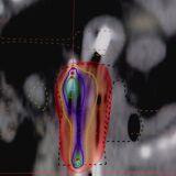 Cover image for research topic "Cervical Cancer: Updates from the Mexican National Consensus"