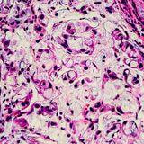Cover image for research topic "Immune Checkpoint Inhibitors in Advanced Gastric and Esophageal Cancers"