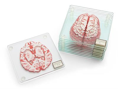 Cover image for research topic "Systems Biology Approaches to Map the Transition from Aging to Alzheimer’s Disease"