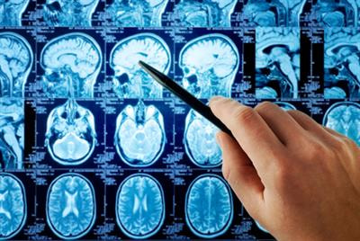 Cover image for research topic "Functional and Structural Connectomics of Mood Disorders"