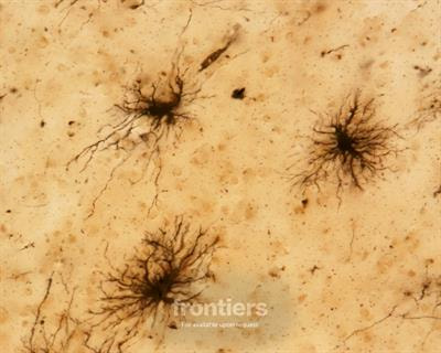 Cover image for research topic "Stress, Neuron-glia Communication, and Neurodegeneration"
