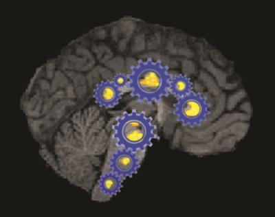 Cover image for research topic "Imaging Biomarkers for the Diagnosis and Prognosis of Neurodegenerative Diseases"