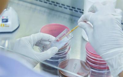 Cover image for research topic "Discerning active TB from latent infection"