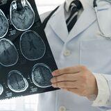 Cover image for research topic "Integrating Health-Related Quality of Life in Neuro-Oncology"