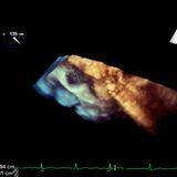 Cover image for research topic "Multi-Parametric Echocardiography in the Detection of Coronary Artery Disease"