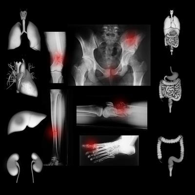 Cover image for research topic "Trauma-Induced, DAMP-Mediated Remote Organ Injury and Immunosuppression in the Acutely Ill Patient"