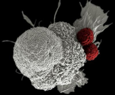Cover image for research topic "Community Series in Personalized Immunotherapy: Advancing Processes to Extend Patient Collectives, Volume II"