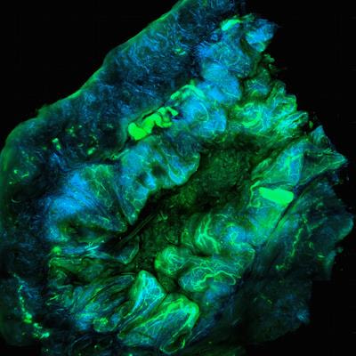 Cover image for research topic "Current Trends and Future Prospects in the Use of Immunotherapy in Ovarian Cancer"