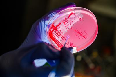 Cover image for research topic "Natural Products from Plants or Microorganisms for the Treatment of Non-Communicable Diseases"