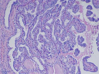Cover image for research topic "New molecular pathways in thyroid biology: Role of coding and noncoding genes in thyroid
pathophysiology, volume II"