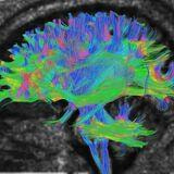 Cover image for research topic "Application of Emerging Technologies in the Diagnosis and Treatment of Patients with Brain Tumors: New Frontiers in Imaging for Neuro-oncology"