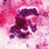 Cover image for research topic "Innate Immune Pathways as Targets for Developing Therapeutic Intervention against Human Cancers"