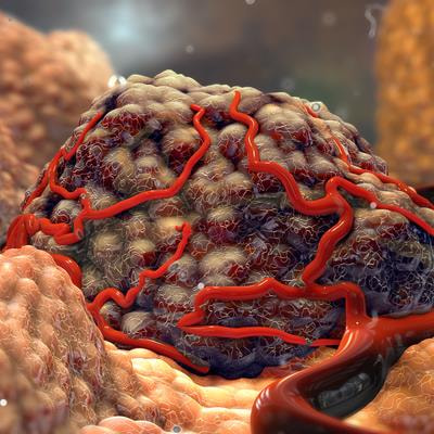 Cover image for research topic "Abnormal Angiogenesis in Tumors and the Improvement of Antiangiogenic Drugs"