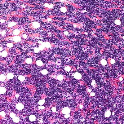 Cover image for research topic "Advancements in Hematopoietic Stem Cell Proliferation and Self-Renewal Maintenance"