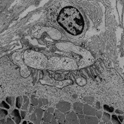 Cover image for research topic "Spotlight on Myasthenia Gravis: Pathomechanisms, diagnostic challenges and novel therapeutic targets"