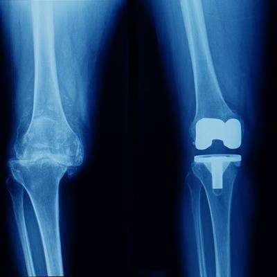 Cover image for research topic "Recent Advancements in Musculoskeletal Regenerative Medicine"