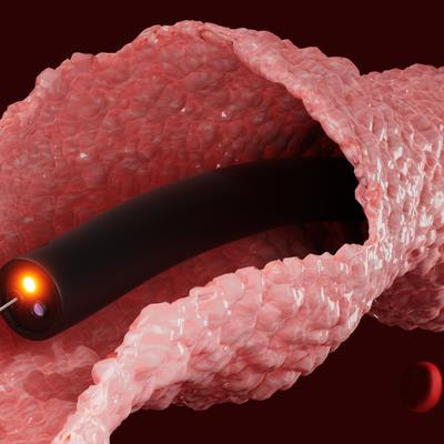 Cover image for research topic "Bio-thermal Medical Devices, Methods, and Models: New Developments and Advances"