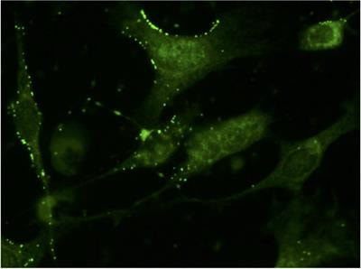 Cover image for research topic "Exosomes in Cardiac Protection and Regeneration"