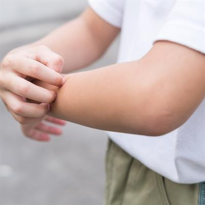 Cover image for research topic "Advances in the diagnosis, management and outcomes of Immune-Mediated Skin Diseases in children"