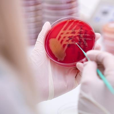 Cover image for research topic "Listeria monocytogenes: Do We Know Enough About This Pathogen?"