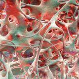 Cover image for research topic "Imaging-Based Methods for Fracture Risk Assessment"