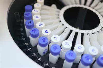 Cover image for research topic "Non-Invasive Methods in Drug Metabolism and Transport: Insights from Biological Samples to Oral Administration"