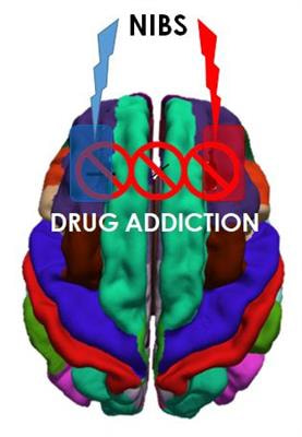 Cover image for research topic "Non-Invasive Brain Stimulation in Drug Addiction"