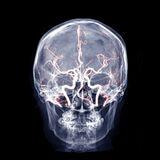 Cover image for research topic "Non-invasive brain stimulation for chronic pain management"