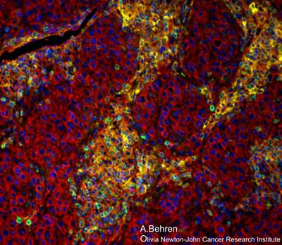 Cover image for research topic "Cancer Plasticity and The Microenvironment: Implications for Immunity and Therapy Response"