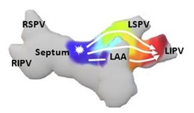 Cover image for research topic "Recent Advances in Understanding the Basic Mechanisms of Atrial Fibrillation Using Novel Computational Approaches"