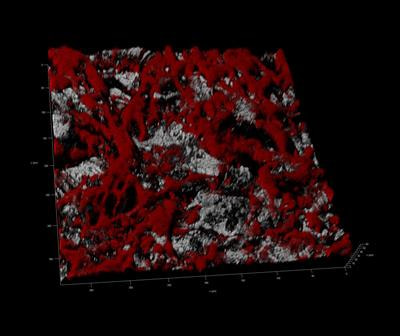 Cover image for research topic "Biofilm concept: from Diagnosis to Treatment of Related Prosthetic Infections"