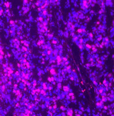 Cover image for research topic "Targeted Therapies for Glioblastoma: A Critical Appraisal"